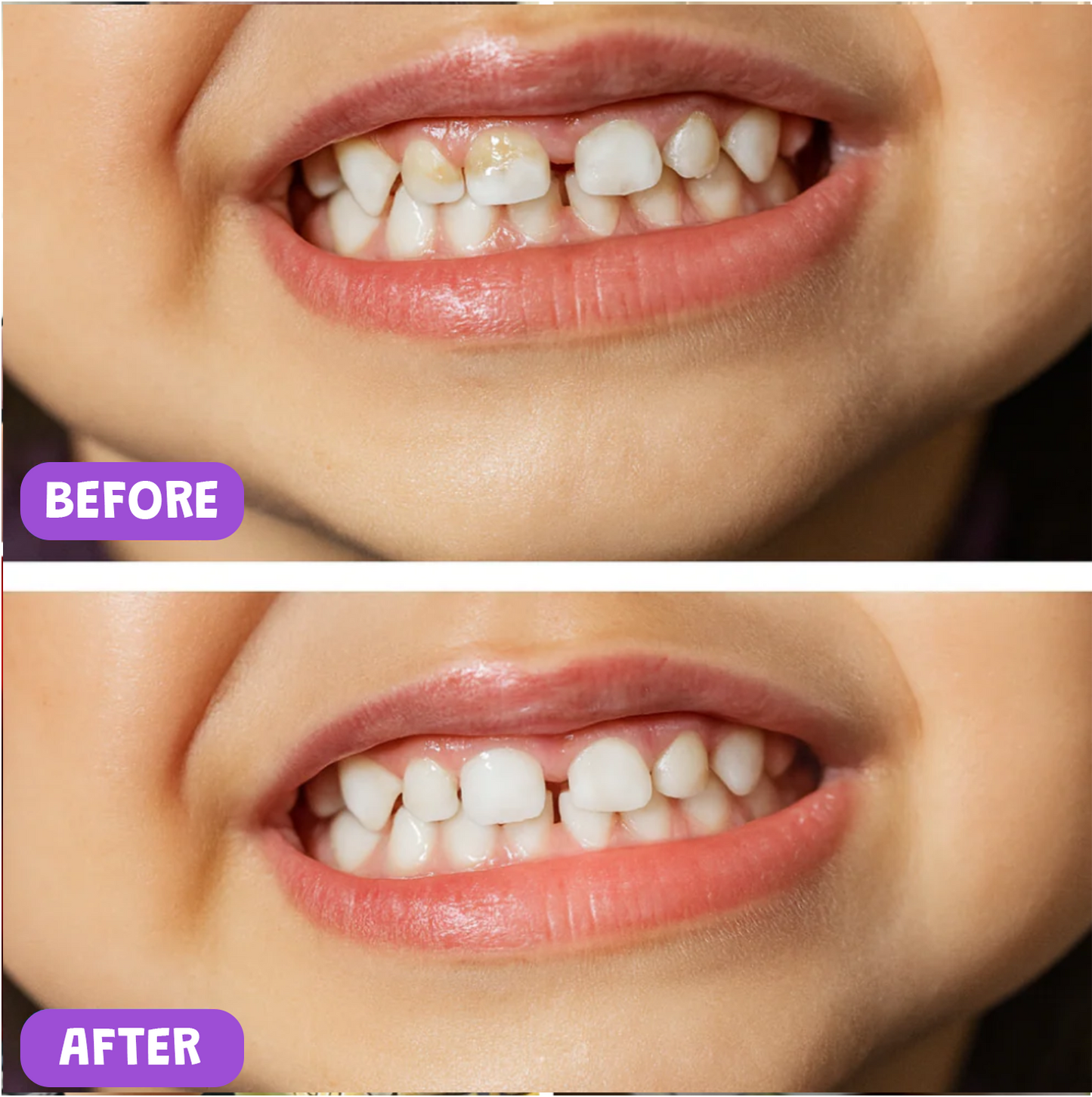 BOOZZYBABY® - Kids Brush